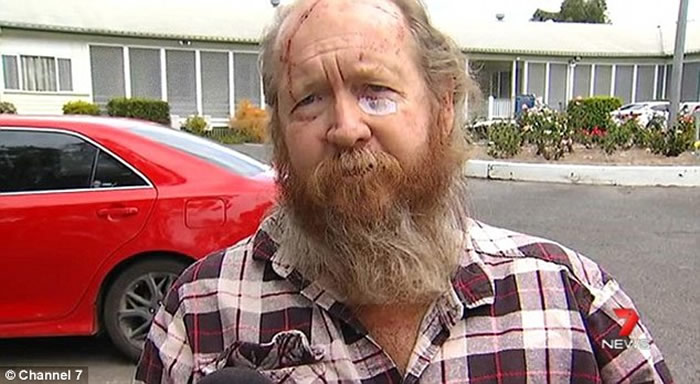 3名澳大利亚人在昆士兰州遭到一只大袋鼠袭击受伤