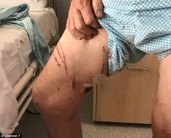 3名澳大利亚人在昆士兰州遭到一只大袋鼠袭击受伤