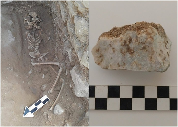 童尸(左图)口中的石块(右图)。