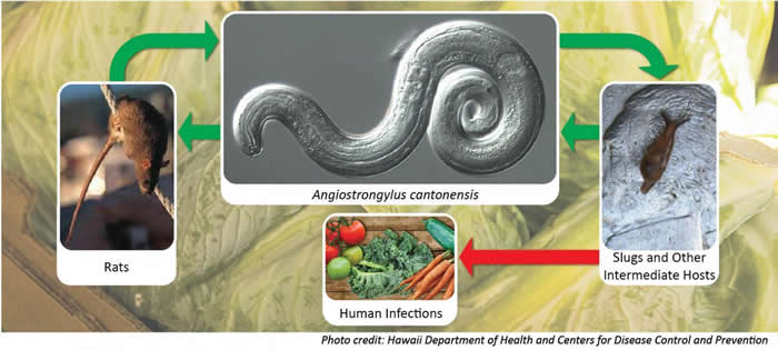 澳大利亚19岁男子打赌吃下鼻涕虫后感染广州管圆线虫病 8年后去世