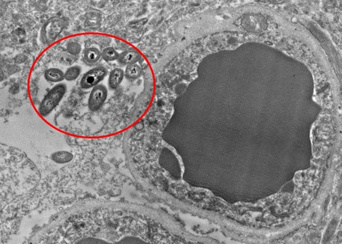 �о���Ա�ڴ�����֯��Ƭ��Ѫ���ԣ����ֳ���ϸ������Ȧ����