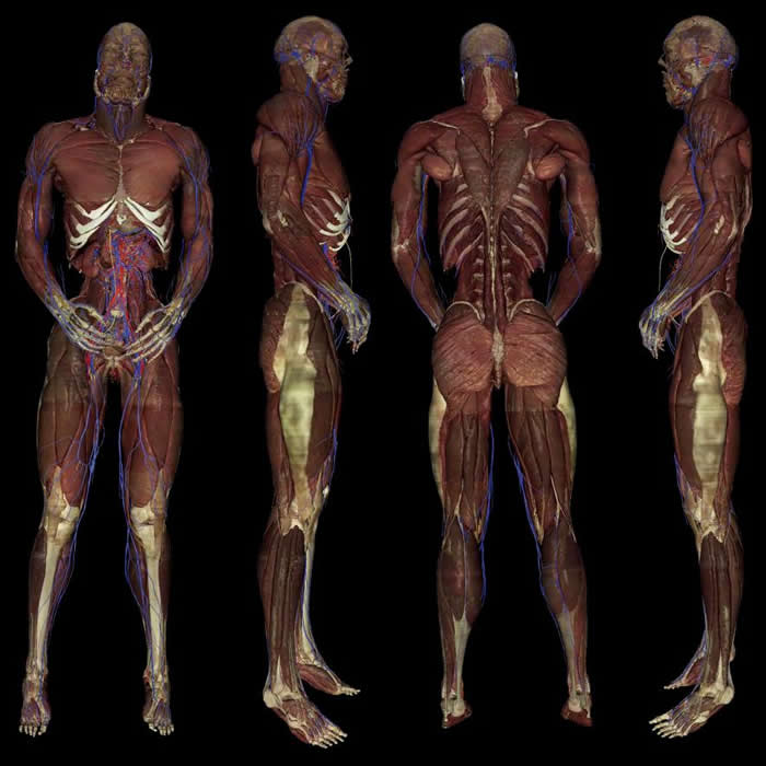 这幅高解析度的立体数位男性影像图,是由维克多.史毕泽(Vic Spitzer)与大卫.惠特拉克(David Whitlock)在科罗拉多大学医学中心制作,也是美