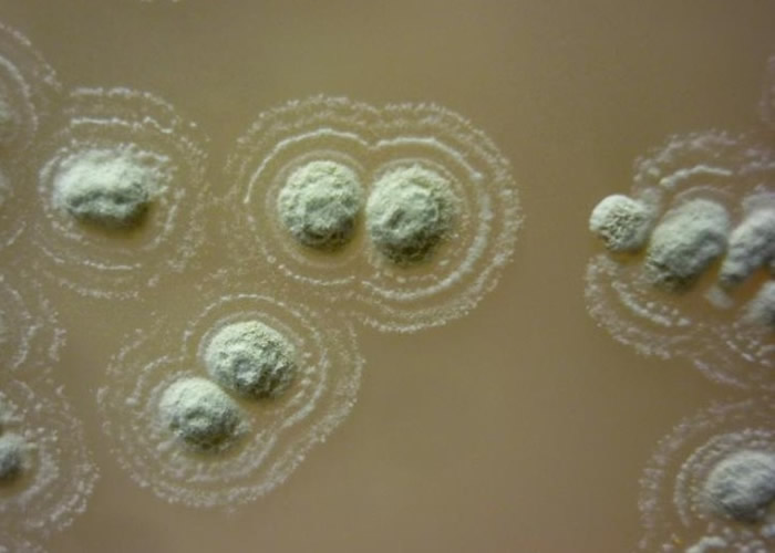 英国斯旺西大学医学院团队分析北爱尔兰古老土壤发现新种菌株 有效抑制超级病菌