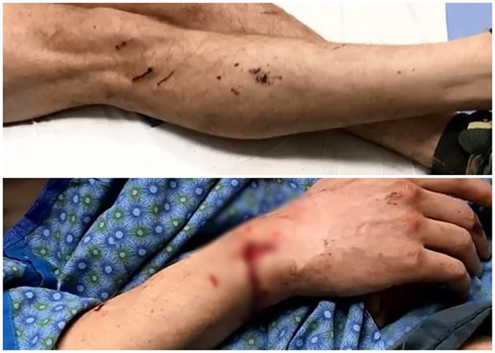 ������ȫ���ദ��ץ�ˡ�