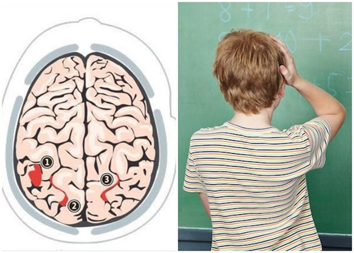 ʧ��֢�����������������˵��¡�