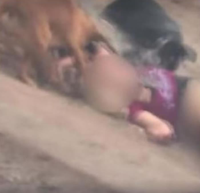 美国阿肯色州27岁女子外出散步遭一群狗围攻咬至遍体鳞伤