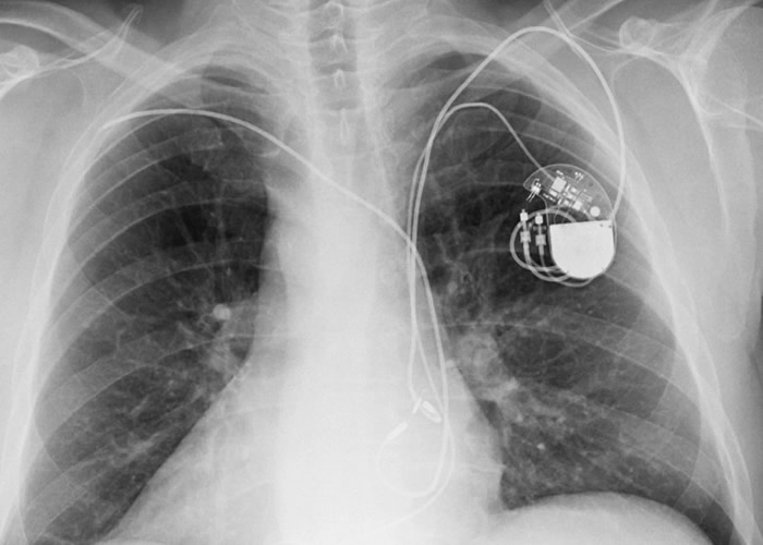 ֲ��ʽ����������л����ܺڿ͹�����