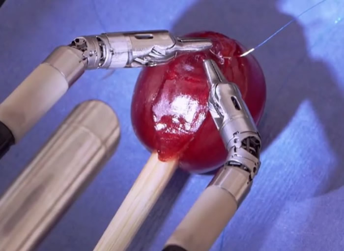 美国公司研发的达芬奇手术机械臂可为葡萄“缝针”