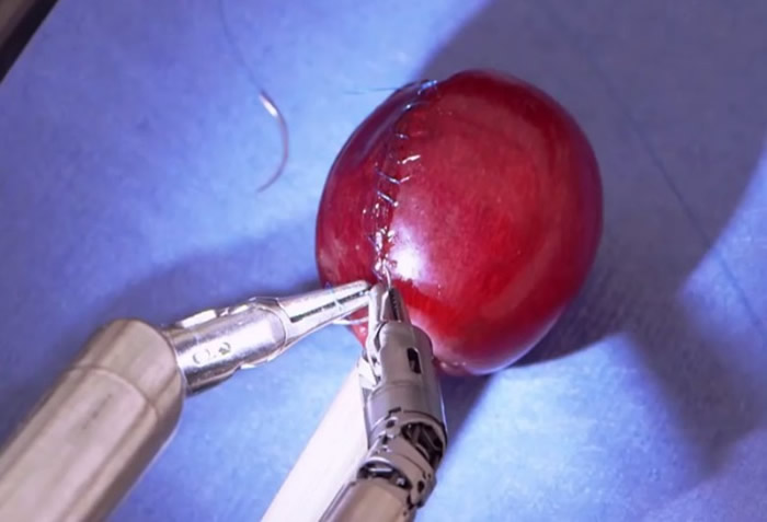 美国公司研发的达芬奇手术机械臂可为葡萄“缝针”