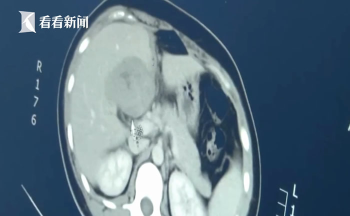 ����ʡ�쳤��Ů���ϸ���ʹ �ϲ�ɨ��һ�վ�Ȼ�Ǹ����ܾ�������