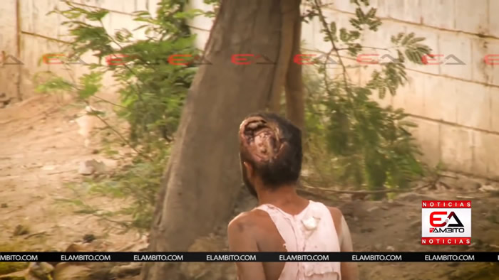 Ӭ���������ױ������˺�ͷ����4000���������ɵ�ͷ����¶