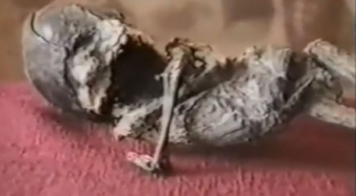 外星人尸体?1996年俄罗斯老奶奶发现的“侏儒小矮人”被证实是核灾难畸形人类婴儿