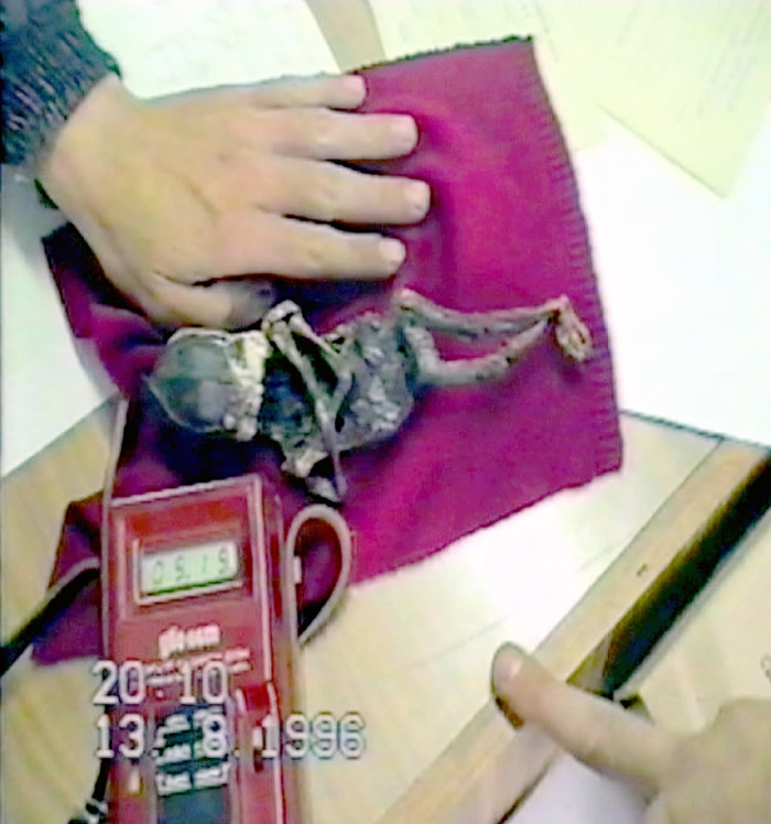 外星人尸体?1996年俄罗斯老奶奶发现的“侏儒小矮人”被证实是核灾难畸形人类婴儿