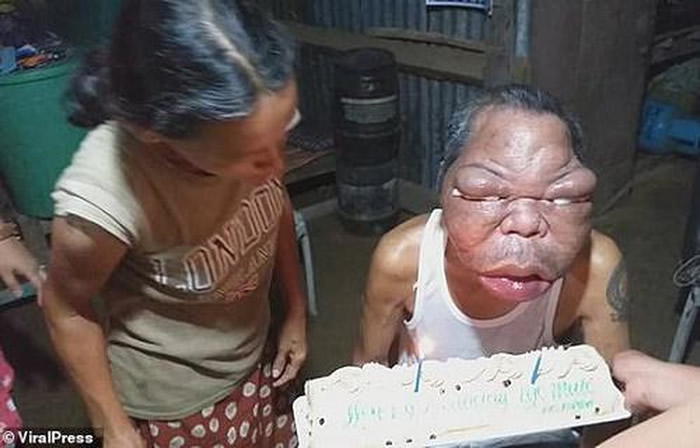 ���ɱ����ص����ӵ��˲������� ���׳���ǰ������