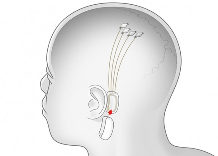 ��Ƭ�ʹ���˿���Դ����Բ��źš�