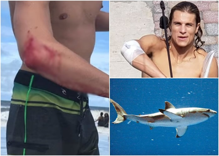 美国职业滑浪选手手肘遭鲨鱼咬 不去医院去酒吧