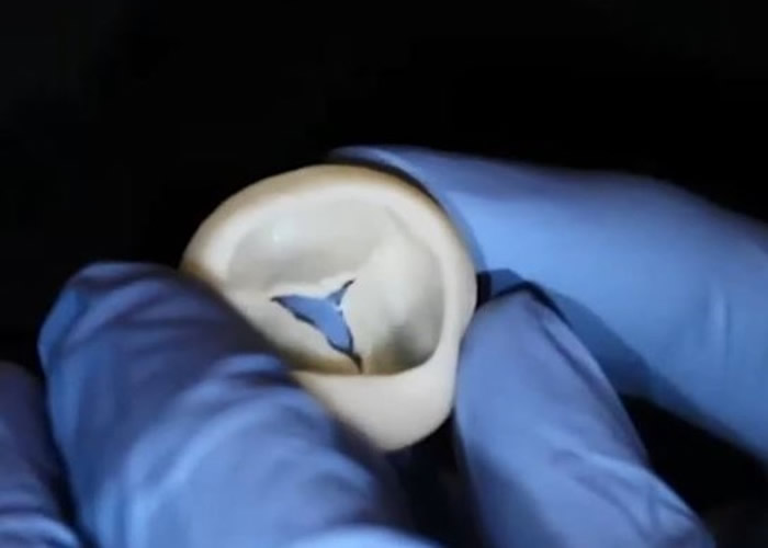 美国卡内基梅隆大学成功用3D生物打印机打印出可运作的心瓣 有望制造出整个心脏