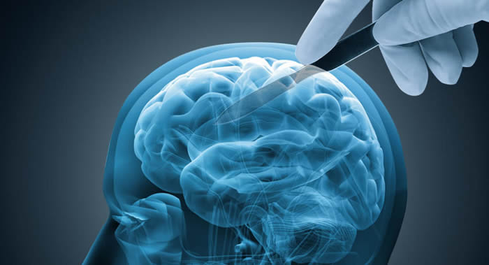 PLoS Medicine�ڿ���һ�������罻���Խ��ͻ��մ�֢�ķ���