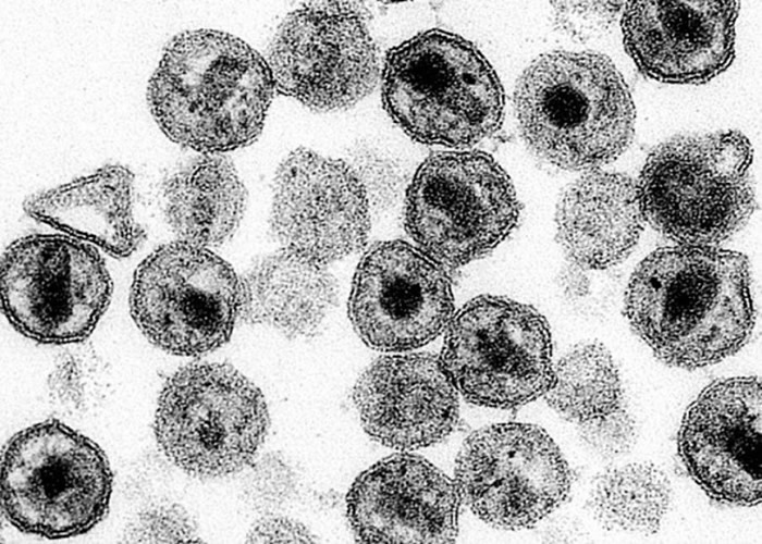 基因编辑技术研究或成治疗艾滋病的新方法