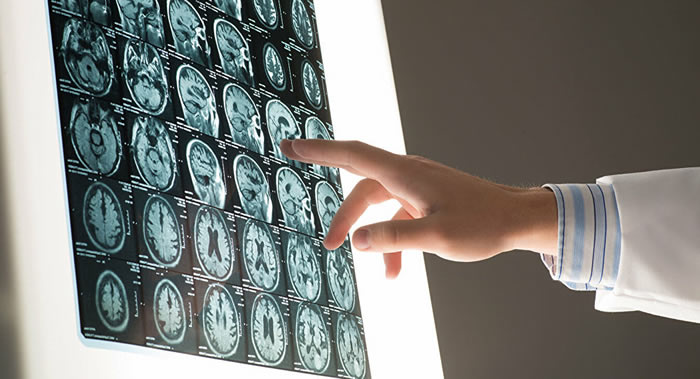 ͫ�׷��ף�Ӣ��Ů���ڶ��ӵ���Ƭ�Ϸ����۰�������Ĥ��������֢״