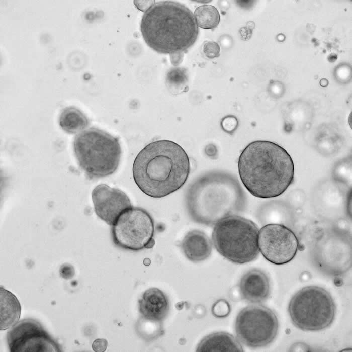 来自患者的类器官可帮助预测晚期结直肠癌(CRC)患者对化疗的反应