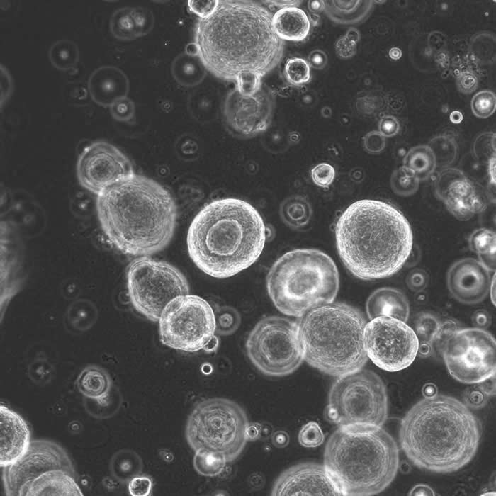 来自患者的类器官可帮助预测晚期结直肠癌(CRC)患者对化疗的反应