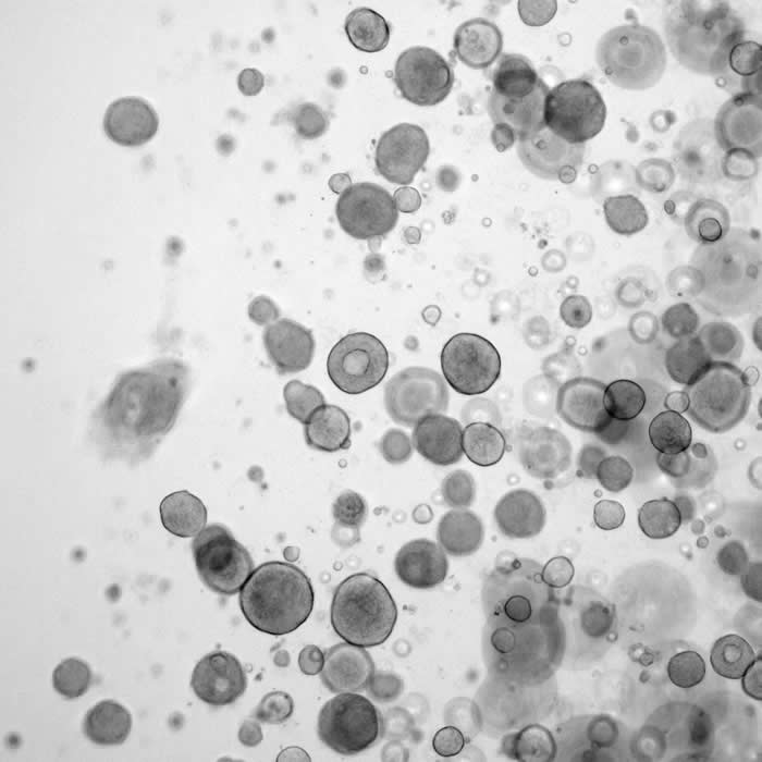 来自患者的类器官可帮助预测晚期结直肠癌(CRC)患者对化疗的反应