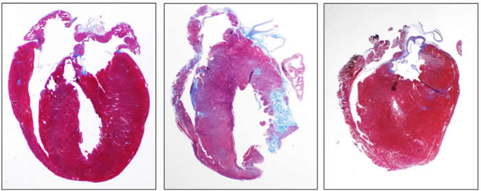 约翰霍普金斯研究人员发现新药有助预防赛场上奔跑的年轻运动员出现心源性猝死