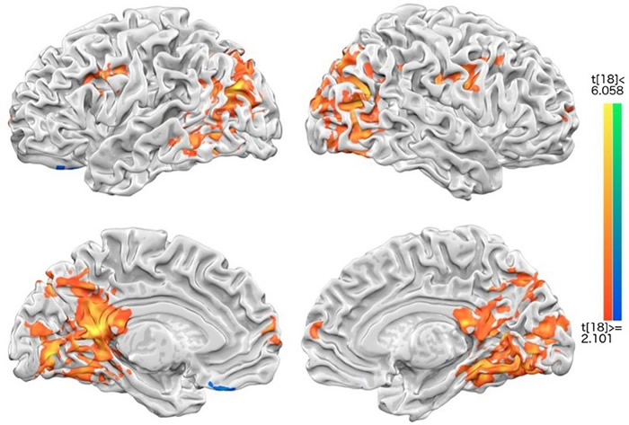 ̨������ɹ���ѧ�о�ɨ����Է����Ҹ������ڡ� ���˻�����ʤ���˳ɾ�