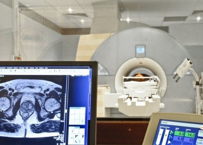 美国患上肛门癌及致死的人数在过去15年上升一倍 九成肛门癌与感染人类乳头瘤病毒(HPV)有关