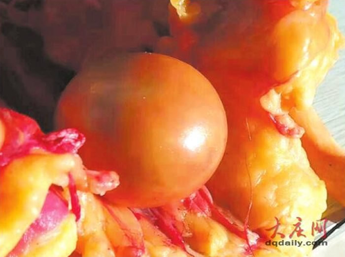 ��˵�еġ�Ѽ������������ʡ�����д�����ɱ��5����Ϲ�Ѽʱ�������������п�ûƤ�ĵ�