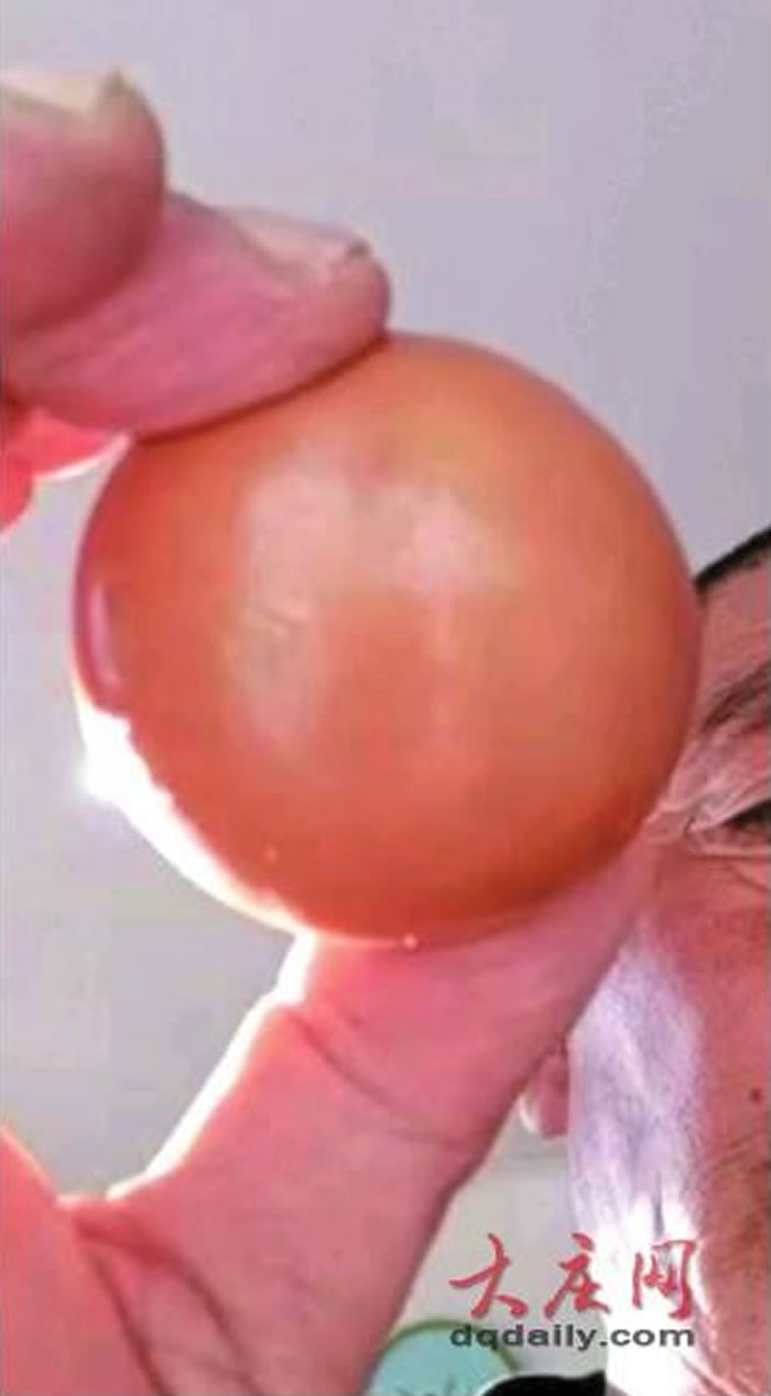 ��˵�еġ�Ѽ������������ʡ�����д�����ɱ��5����Ϲ�Ѽʱ�������������п�ûƤ�ĵ�