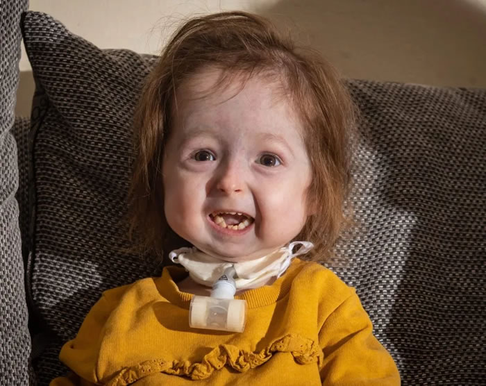 ���ĩ�˷�������֢��Ӣ������Ůͯ����������Ψһ�������������Ͷ١������Ŵ�������