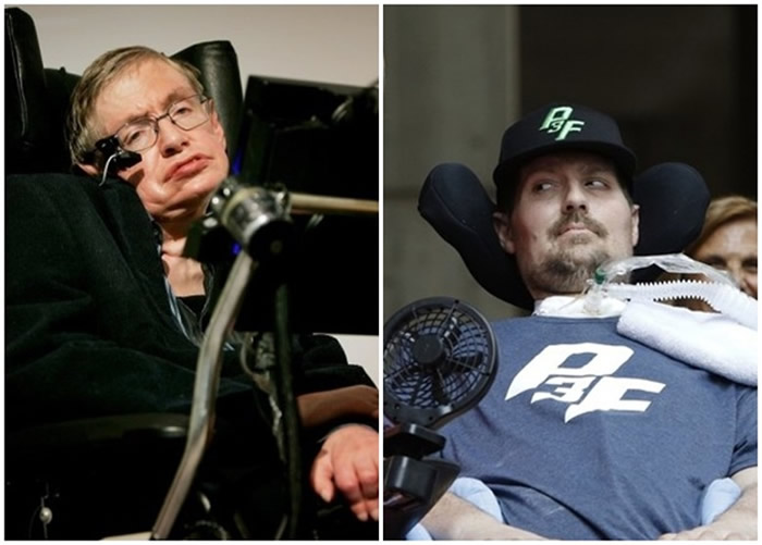 ��������֢������ή���Լ������Ӳ��֢�����ܸ�ϸ���ڵ��̴�������֬��ʧ���й�