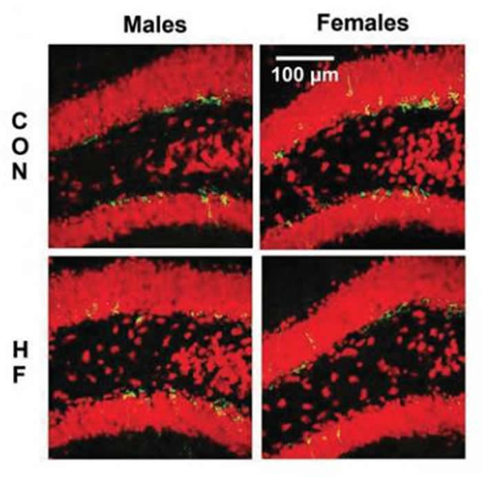 ��֬��ʳ���ܵ���Ů�Գ������ش��Խ�������