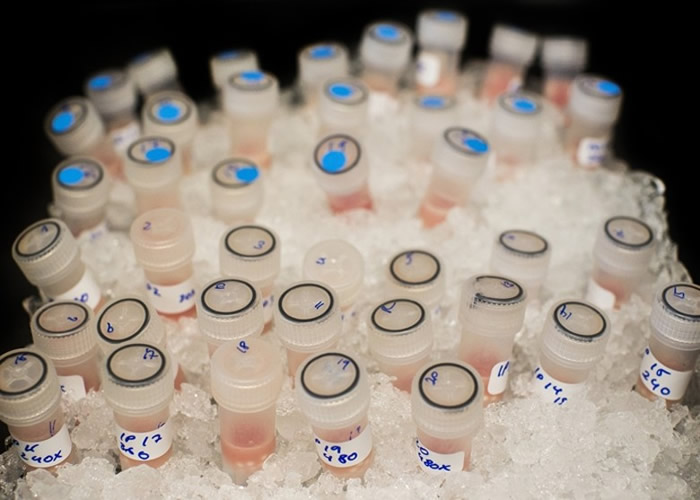 先进治疗技术令美国癌症死亡率下跌