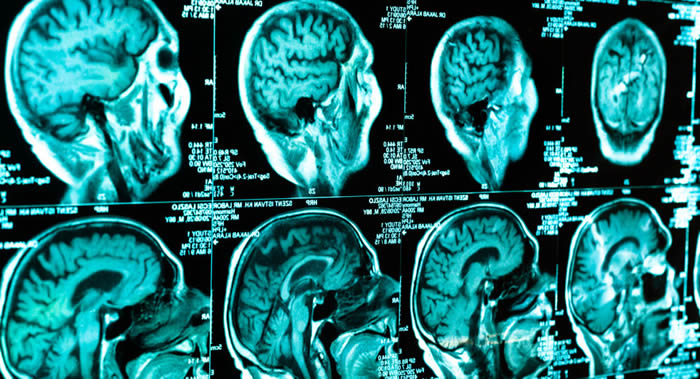 ҽ����Ѷ��վMedicalxpress������20���ӿɸ��ƴ��Թ��� ���糿��һ�������൱