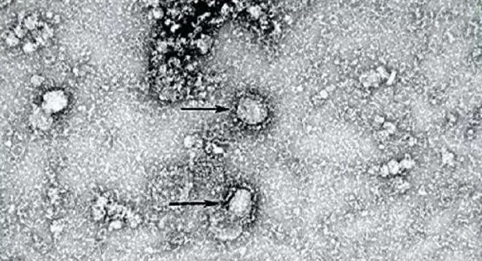 澳大利亚墨尔本的Doherty研究所科学家成功地培育出新型冠状病毒
