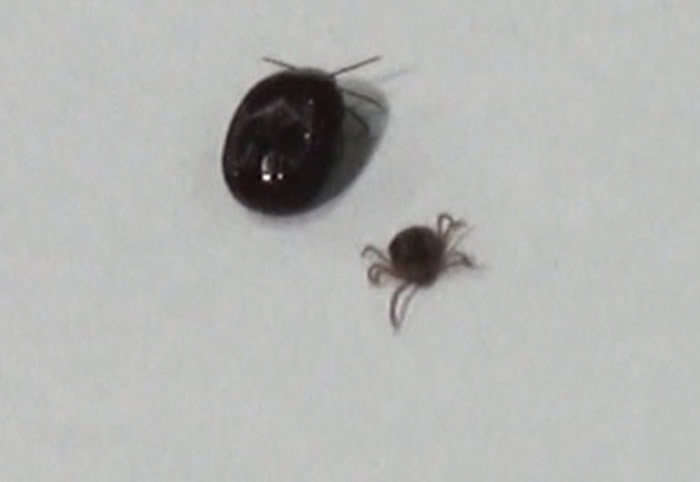 日本男子被蜱叮咬感染新病毒