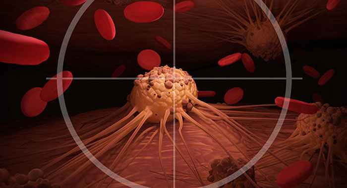 肿瘤医生介绍苹果公司创始人史蒂夫·乔布斯患胰腺神经内分泌肿瘤无法被治愈的原因