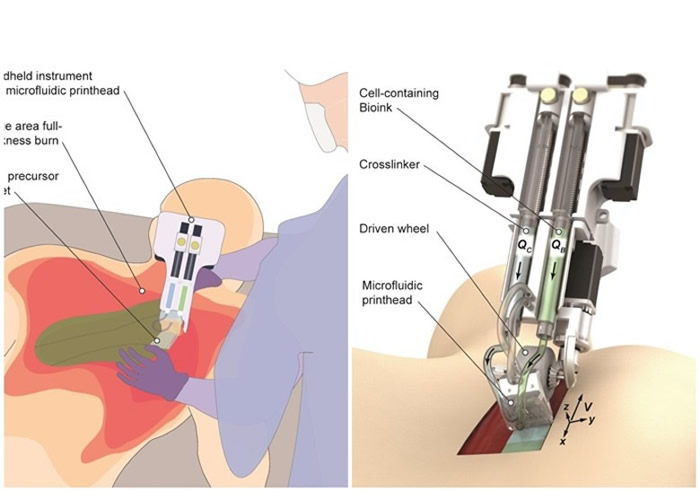 ���ô������ֳ�ʽ3DƤ����ӡ�� ��ֱ�����˿ڡ���ӡ����Ƥ��ϸ����������������