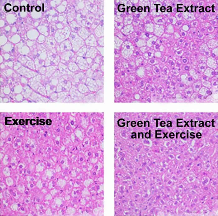 运动与绿茶提取物结合起来或能缓解非酒精性脂肪肝发展