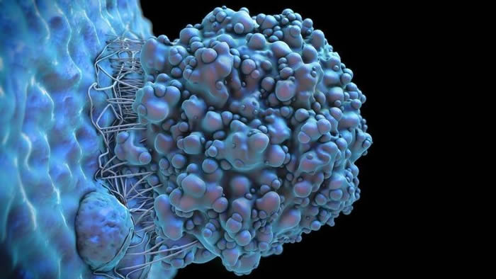 实验室模型显示联合药物疗法在儿童脑肿瘤治疗方面具有前景