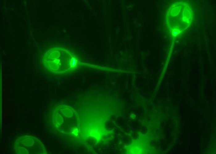 以色列研究发现三文鱼“黏孢子寄生虫”完全不需依赖呼吸氧气生存