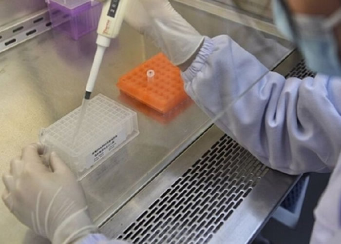 研究指新冠肺炎复发患者较年轻 检测试剂需改善