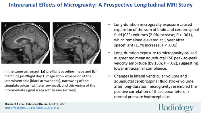 ������ѧ����־���Ա�ڹ��ʿռ�վͣ������Եİ��ʷ������Ա仯