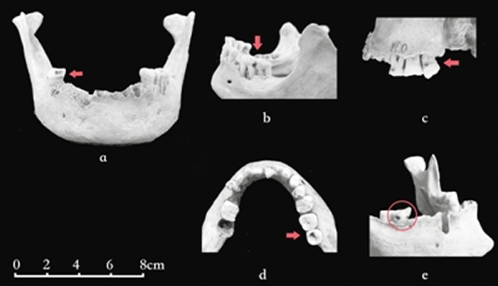 ���˵�ȣ��й¶����Щ����