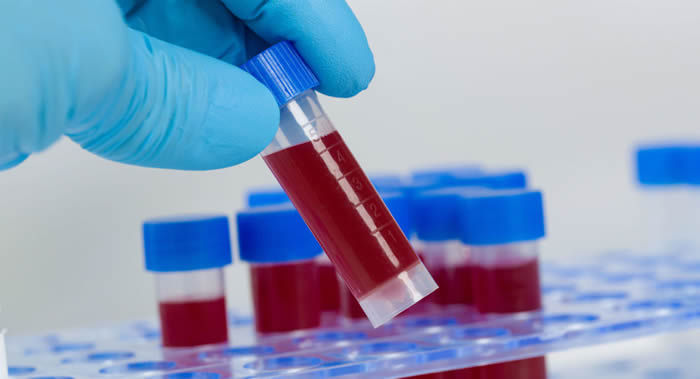 《自然》杂志:血红蛋白这种运输氧气的蛋白质产生于发生在数百万年前的两次突变