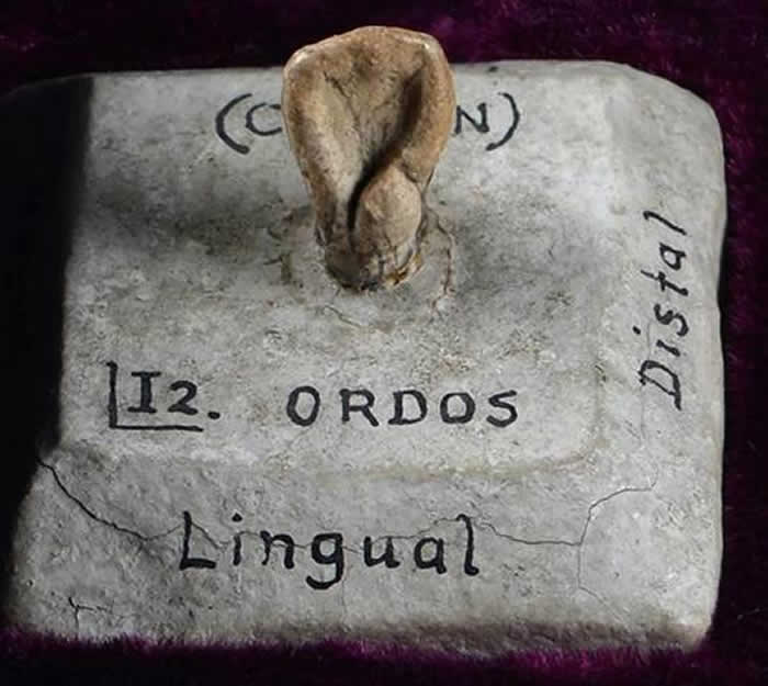 “河套人”牙齿模型(牙冠面)