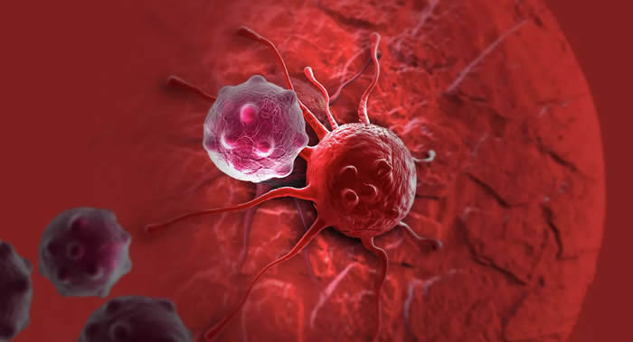 95%的肿瘤来自癌前病变 癌症起因是一个炎症的过程